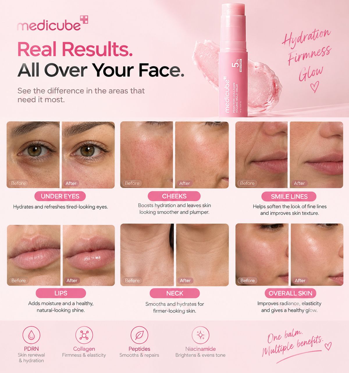 MEDICUBE PDRN Pink Collagen Volume Multi Balm